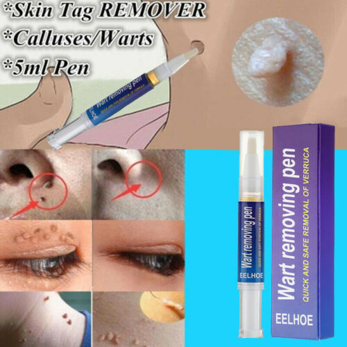 Original Wart Removal pen – Professional-Grade pen for Warts, Moles & Skin Tags | Fast-Acting, Gentle & Antibacterial Formula for Clear, Healthy Skin
