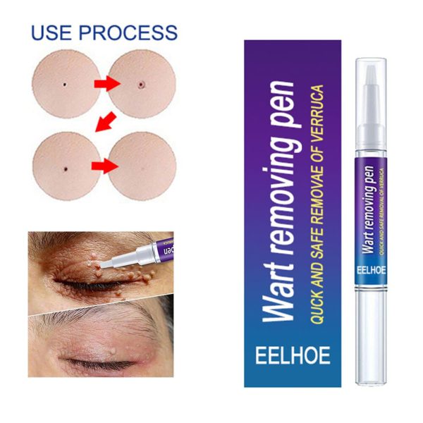 Original Wart Removal pen – Professional-Grade pen for Warts, Moles & Skin Tags | Fast-Acting, Gentle & Antibacterial Formula for Clear, Healthy Skin