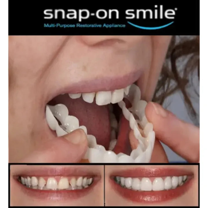 Pack Of 2 Pairs Snap-On Smile Custom Fit