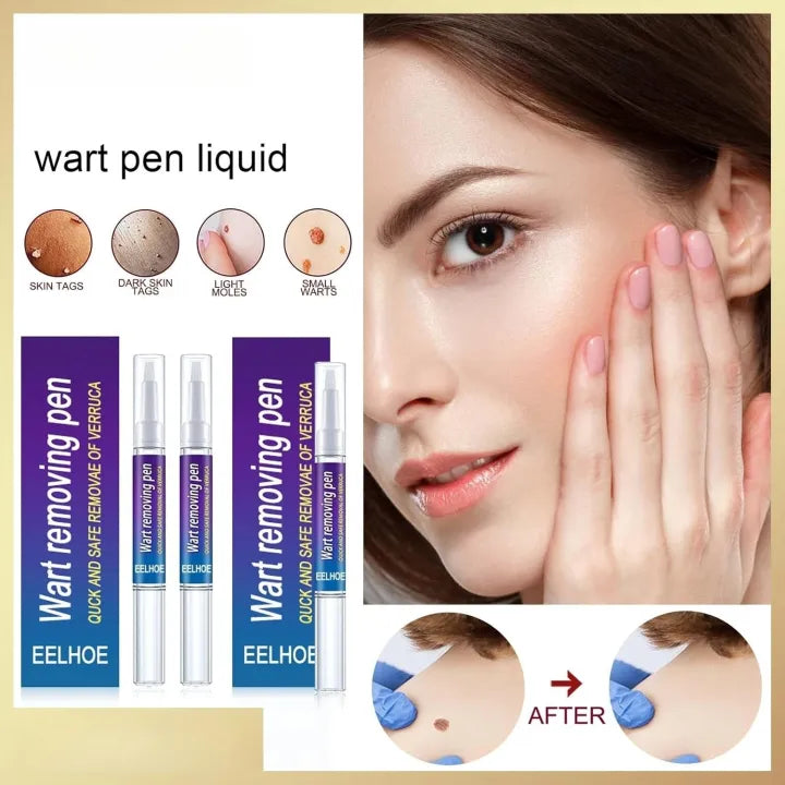 Wart Removing Pen | Instant Solution | Clinically Approved