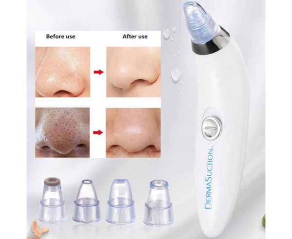 Blackhead Suction Remover & Pore Vacuum | Cell Operated