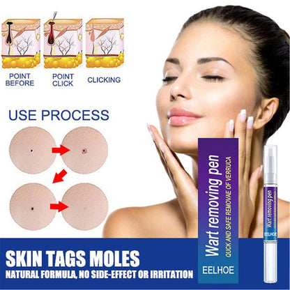 Original Wart Removal pen – Professional-Grade pen for Warts, Moles & Skin Tags | Fast-Acting, Gentle & Antibacterial Formula for Clear, Healthy Skin